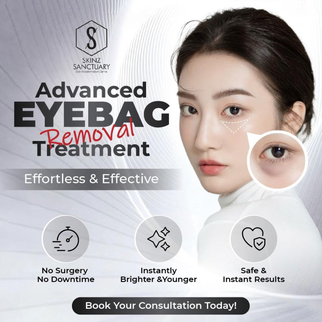 Recommended item